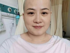 岳云鹏老婆回应生病剃光头 只是需要做个小手术